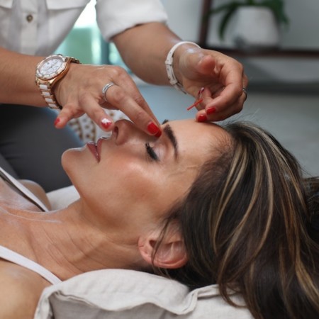 acufacial, acupuncture,